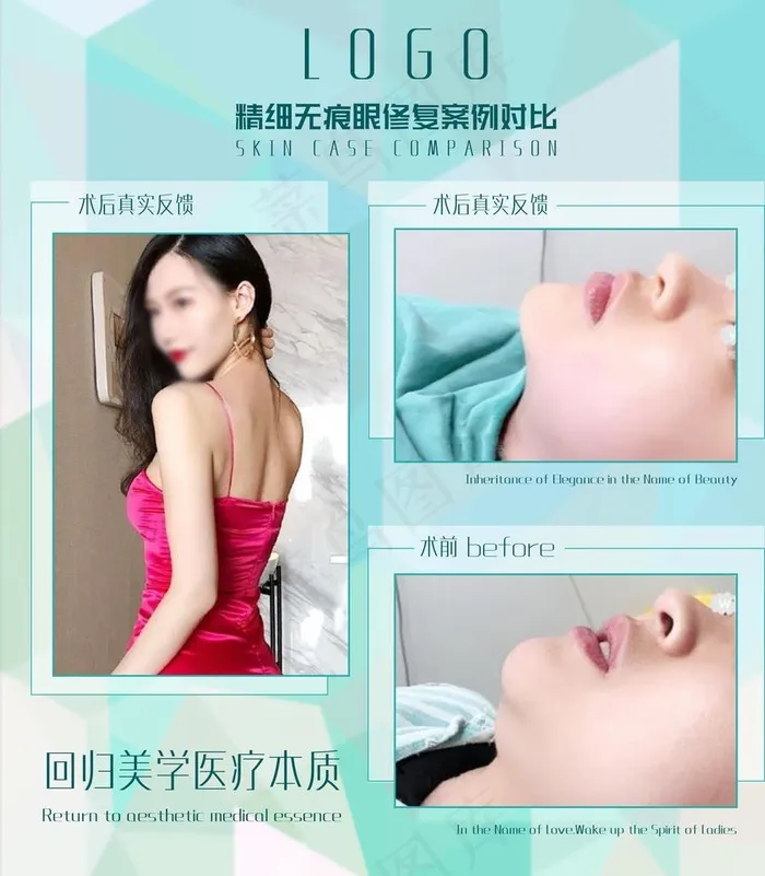 医美案例对比图图片(4266X4713(DPI:300))psd模版下载
