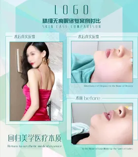 医美案例对比图图片