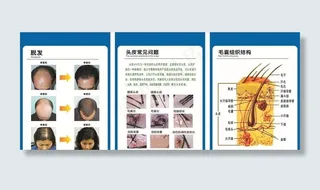 头皮护理 损伤案例 头皮常见问图片
