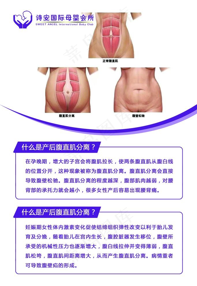产后腹直肌分离图片psd模版下载