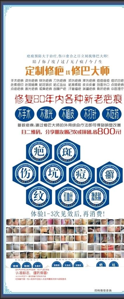 祛疤展架图片(210X297)cdr矢量模版下载