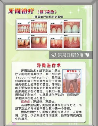 口腔科 牙周治疗图片