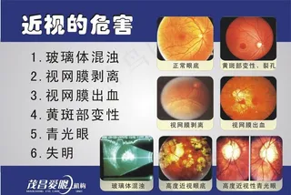 近视的危害图片