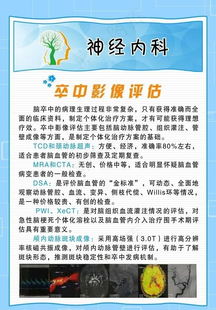 卒中影像评估图片