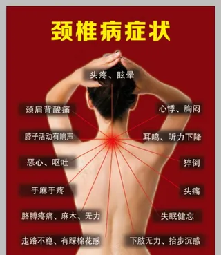 颈椎病症状 海报图片