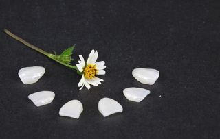 活动假牙 隐形义齿图片