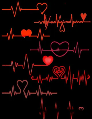 心电图套图图片