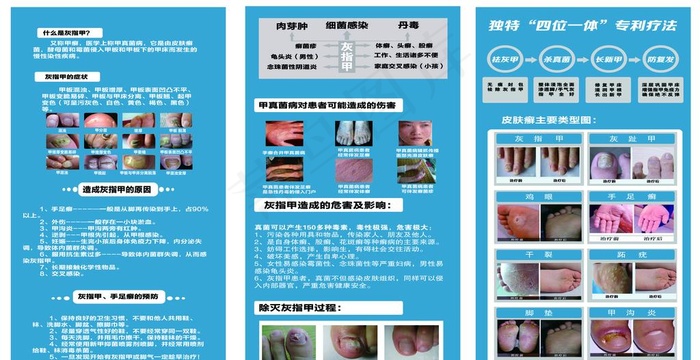 灰指甲图片