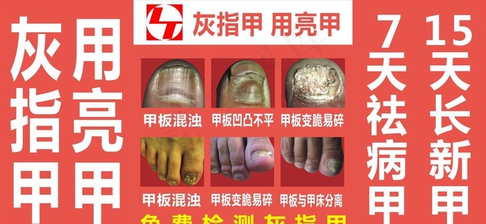 亮甲图片cdr矢量模版下载