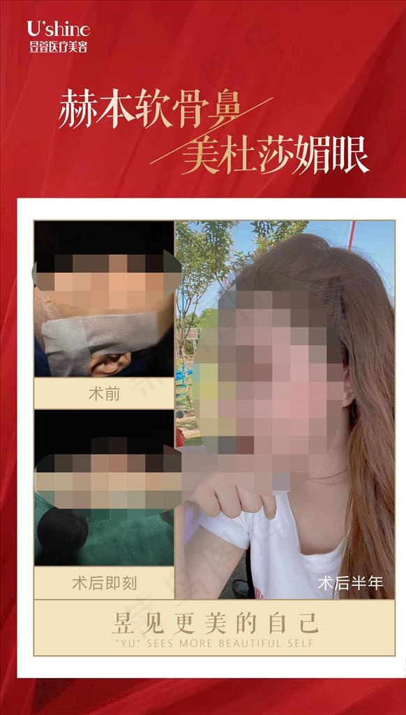 医美整形医院案例对比海报图片