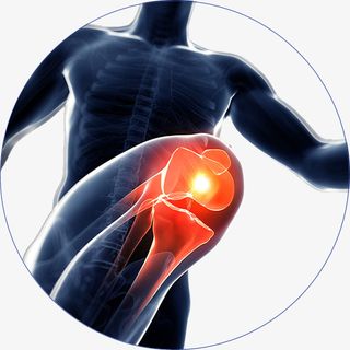 人体骨骼关节炎效果图免抠