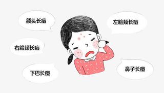 额头长痘悲伤女孩免抠