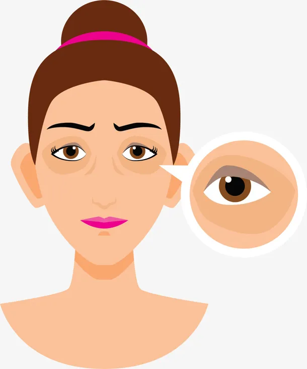 眼袋皱纹卡通女孩免抠