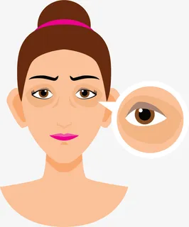 眼袋皱纹卡通女孩免抠 眼袋皱纹卡通女孩免抠