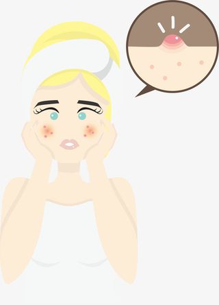 脸部长痘痘的金发女人免抠