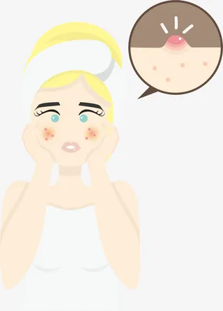 脸部长痘痘的金发女人免抠