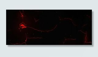 红色血丝简约医疗黑色背景高清