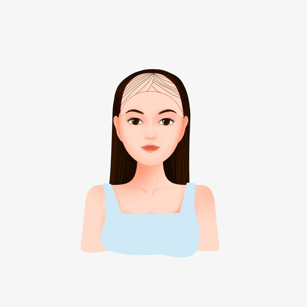 年轻的女性脱发掉发了免抠