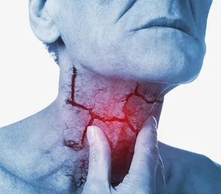 咽喉 咽炎 喉炎 喉部不适免抠