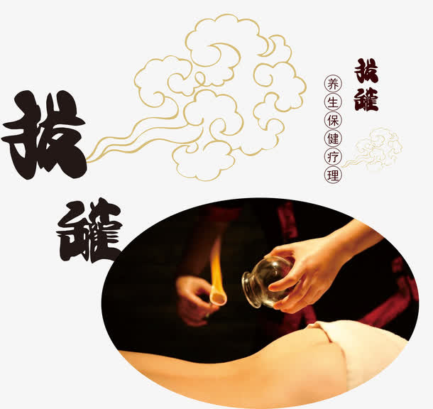 把火罐素材免抠