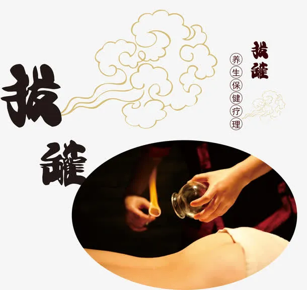 把火罐素材免抠