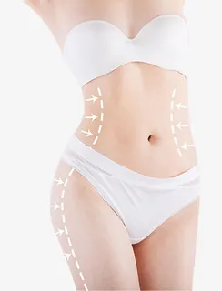 减肥抽脂模特免抠