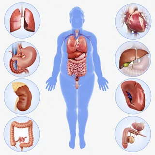 肥胖成年男性内脏器官医学插画免抠