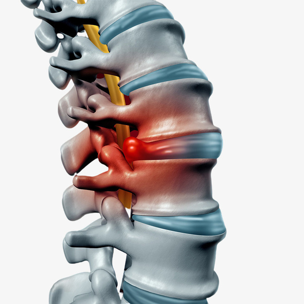 尾椎 骨刺  腰椎 颈椎免抠
