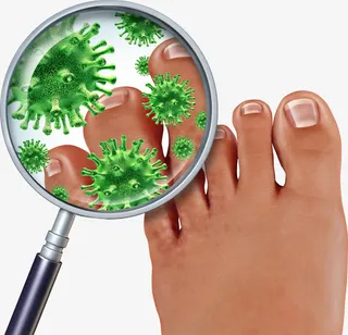 脚气病菌免抠