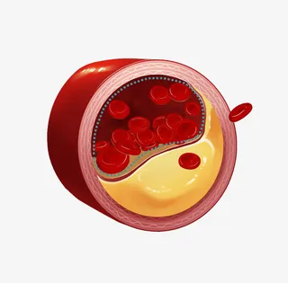 血管感染卡通插画免抠