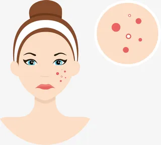 卡通烦恼长痘女生免抠