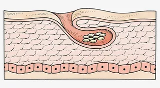 皮肤结构插图免抠