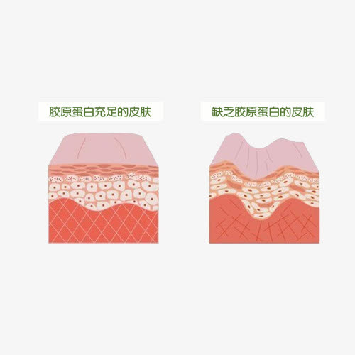 胶原蛋白皮肤免抠