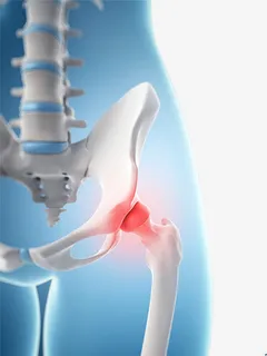 骨盆关节疼痛插图免抠