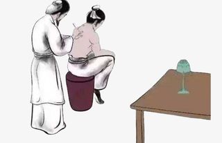 中国风中医针灸免抠