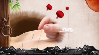 屋檐中国风针灸中医养生海报背景素材高清