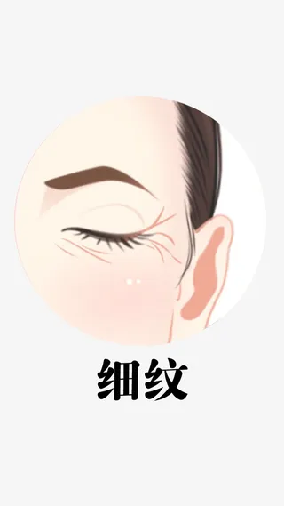 抬头纹，鱼尾纹，法令纹，卡通素材免抠