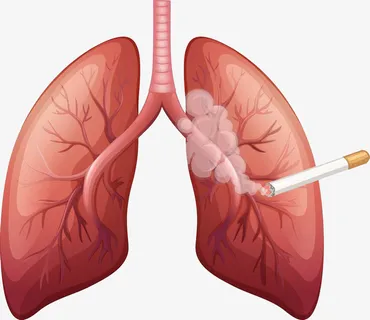 烟草和肺卡通插画免抠