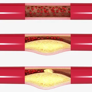 心动脉血管卡通插画免抠