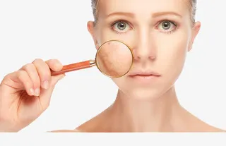 放大肌肤问题免抠