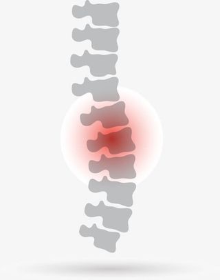 脊椎矢量图免抠