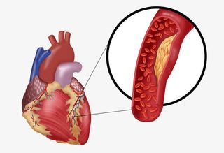 心脏血管图片免抠