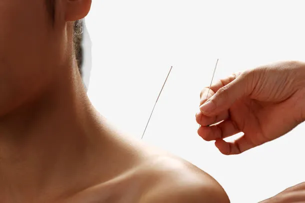 针灸免抠素材免抠