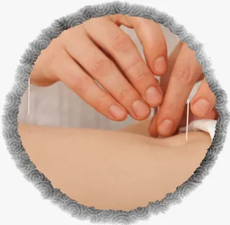 针灸养生疗法免抠