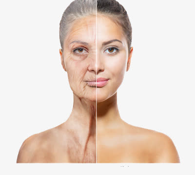 皮肤衰老对比免抠