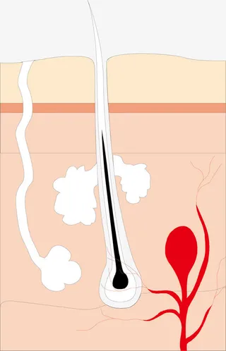 汗毛孔结构免抠