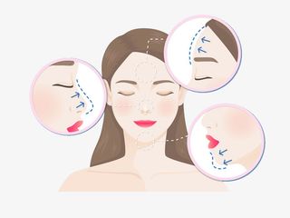 韩式女士整容微整漫画免抠