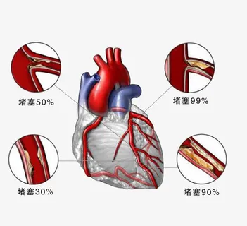 心脏疾病免抠 心脏疾病免抠