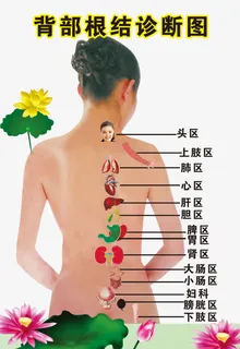 背部根结诊断图免抠