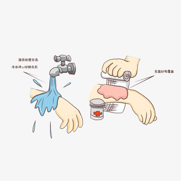 卡通手臂烧伤的处理方法素材免抠